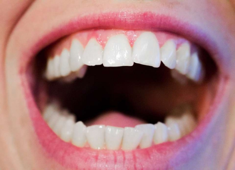 牙斑净腐蚀牙齿么牙齿健康的重要性有哪些